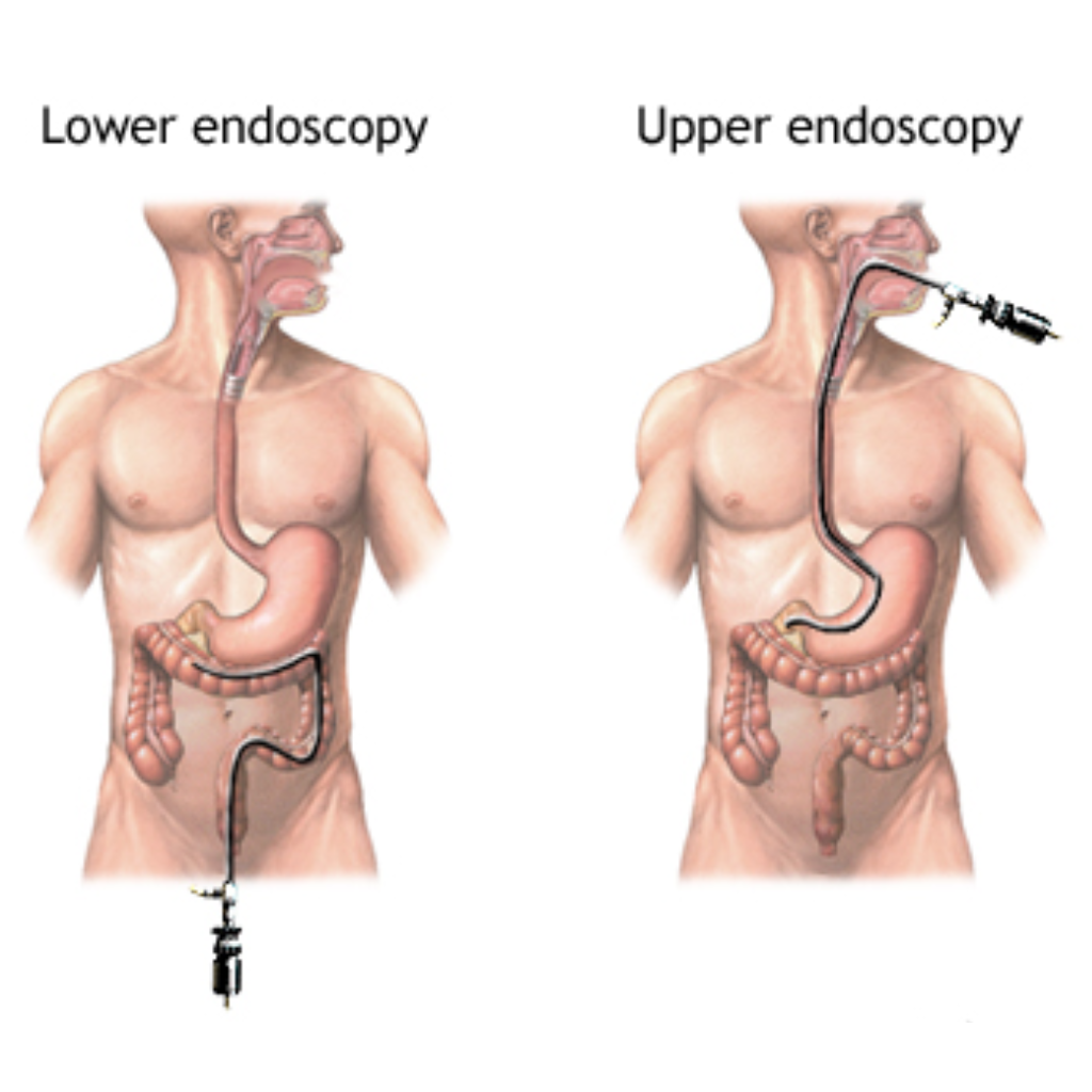 Best Endoscopy Center In Kalyan Near Me