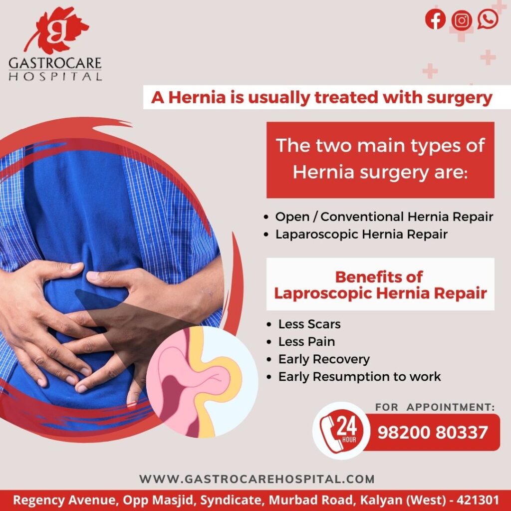 BEST HOSPITAL FOR HERNIA TREATMENT IN KALYAN